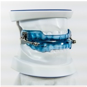 ApneaGuard Oral Appliance for Sleep Bruxism and Sleep Apnea